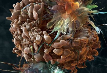 EFFETTO WARBURG ED EFFETTO HOFFMAN…..TRA LE BASI BIOLOGICHE DEL TUMORE