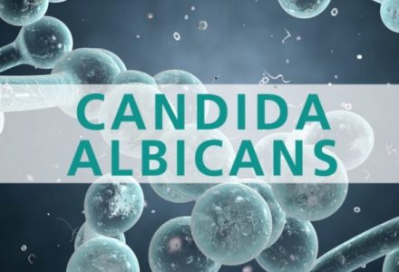 CANDIDA, LO SAPEVI CHE……..