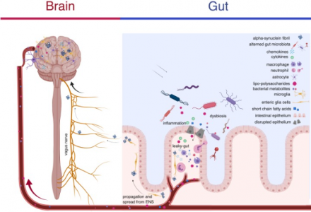 MICROBIOTA E PARKINSON……..UNA NUOVA PROSPETTIVA